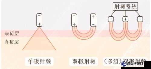 433mh2 射頻對人體有影響嗎必讀小貼士：了解射頻輻射，保護身體健康